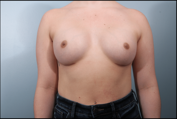 After image