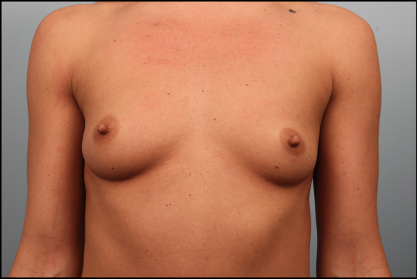 Before image