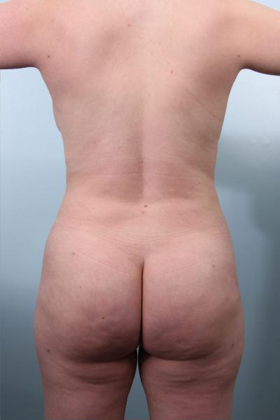 After image