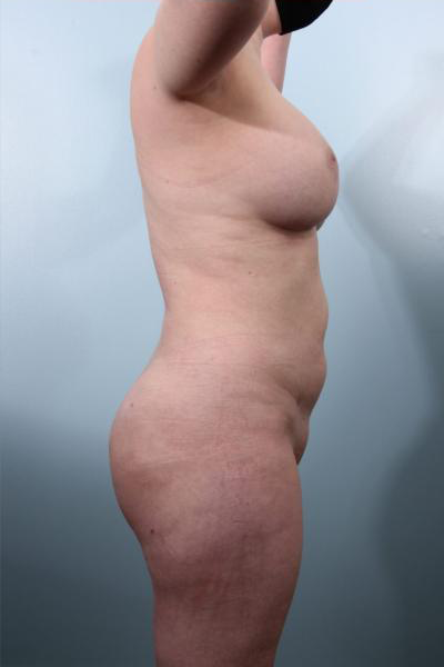 After image