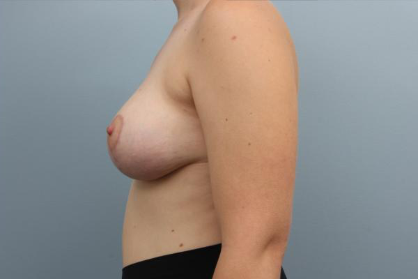 After image