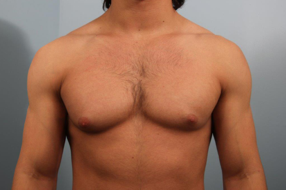 Before image