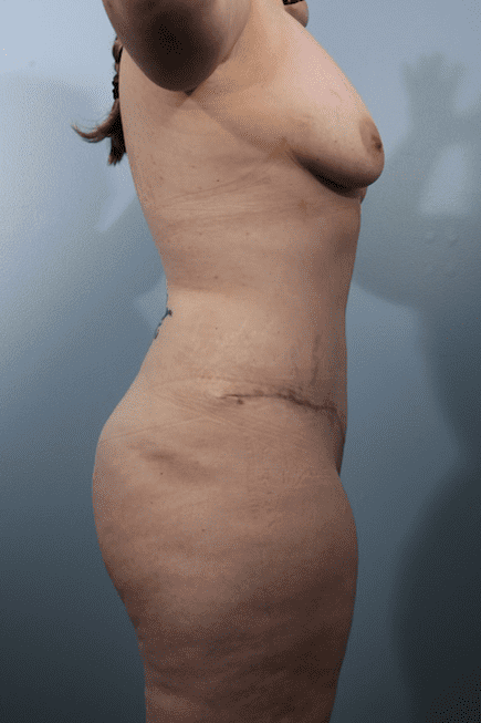 After image