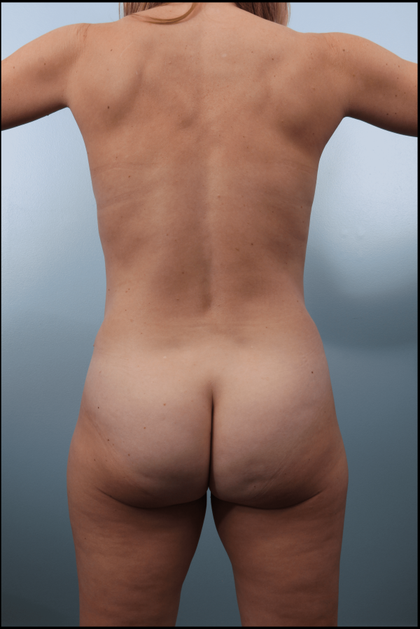 After image