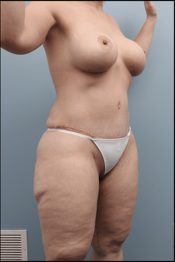 After image