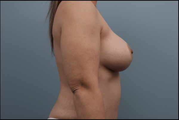 After image
