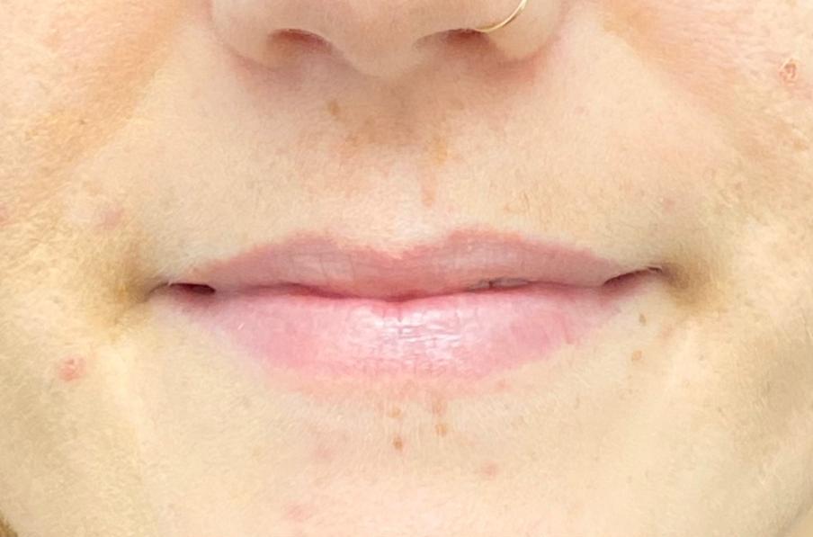 Before image